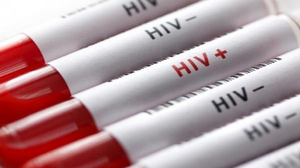 درمان آزمایشی HIV وارد تست انسانی شد