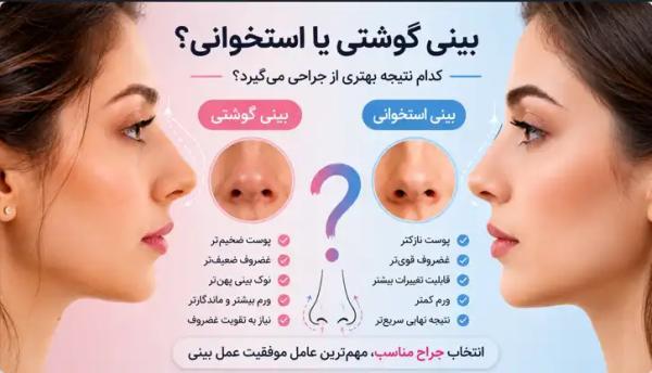 بینی گوشتی یا استخوانی؟ تفاوت ها، روش تشخیص و نتیجه جراحی در هر نوع بینی